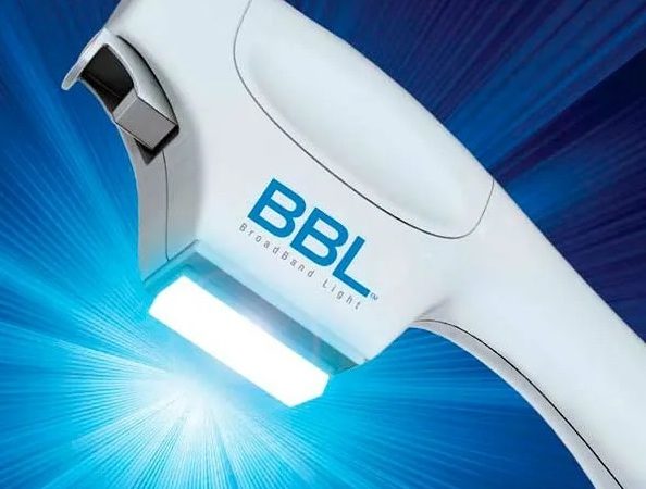 Фототерапия BBL: как свет побеждает сосудистые патологии